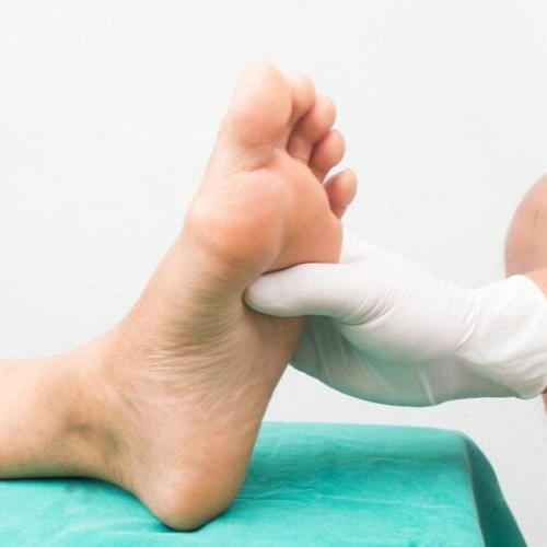 Diabetic Foot Syndrome - Treatment & Prevention